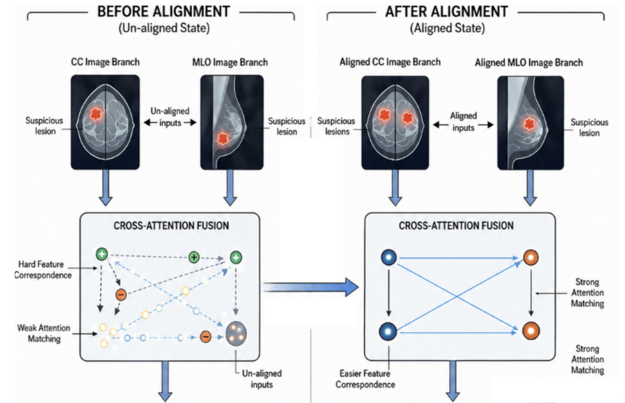 Attention-augmented Dual-View Mammogram Alignment for Enhanced BI-RADS Classification