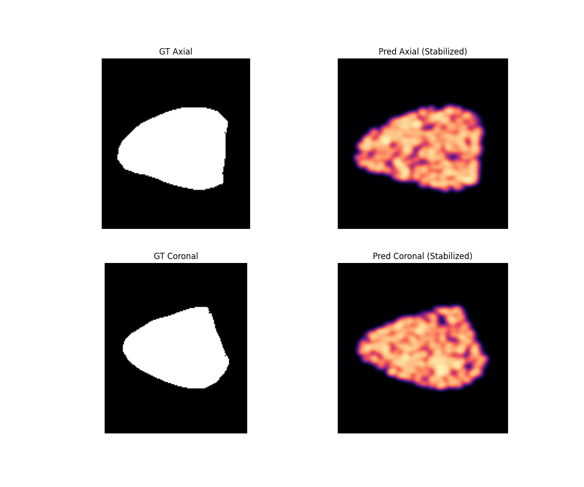 Ground truth and predicted axial and coronal reconstruction comparison
