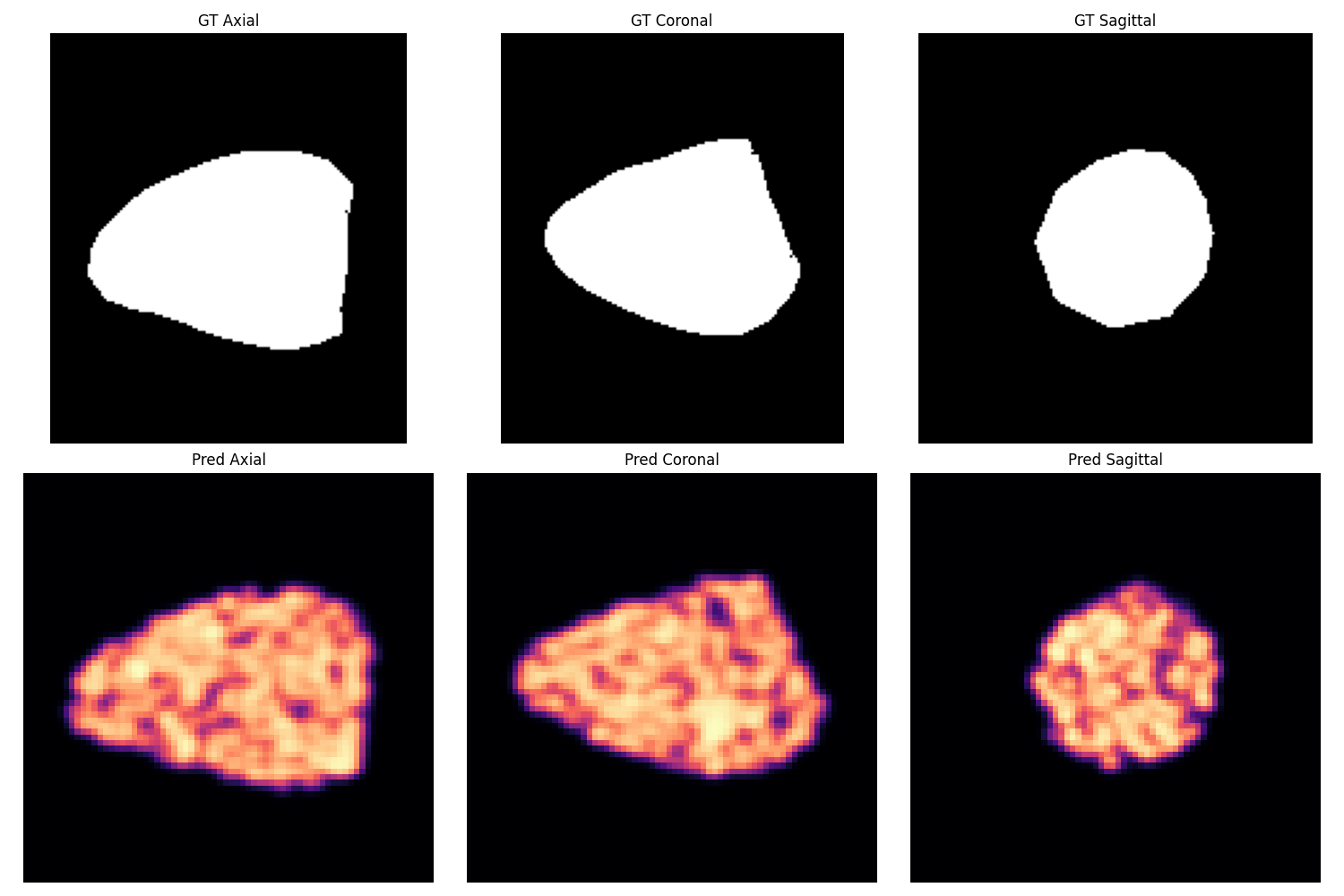 Gallery of ground truth and predicted axial, coronal, and sagittal slices