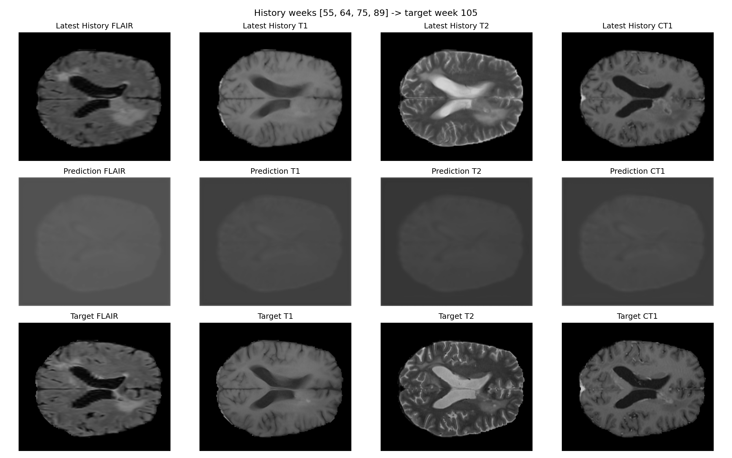 Prediction and target for patient 007