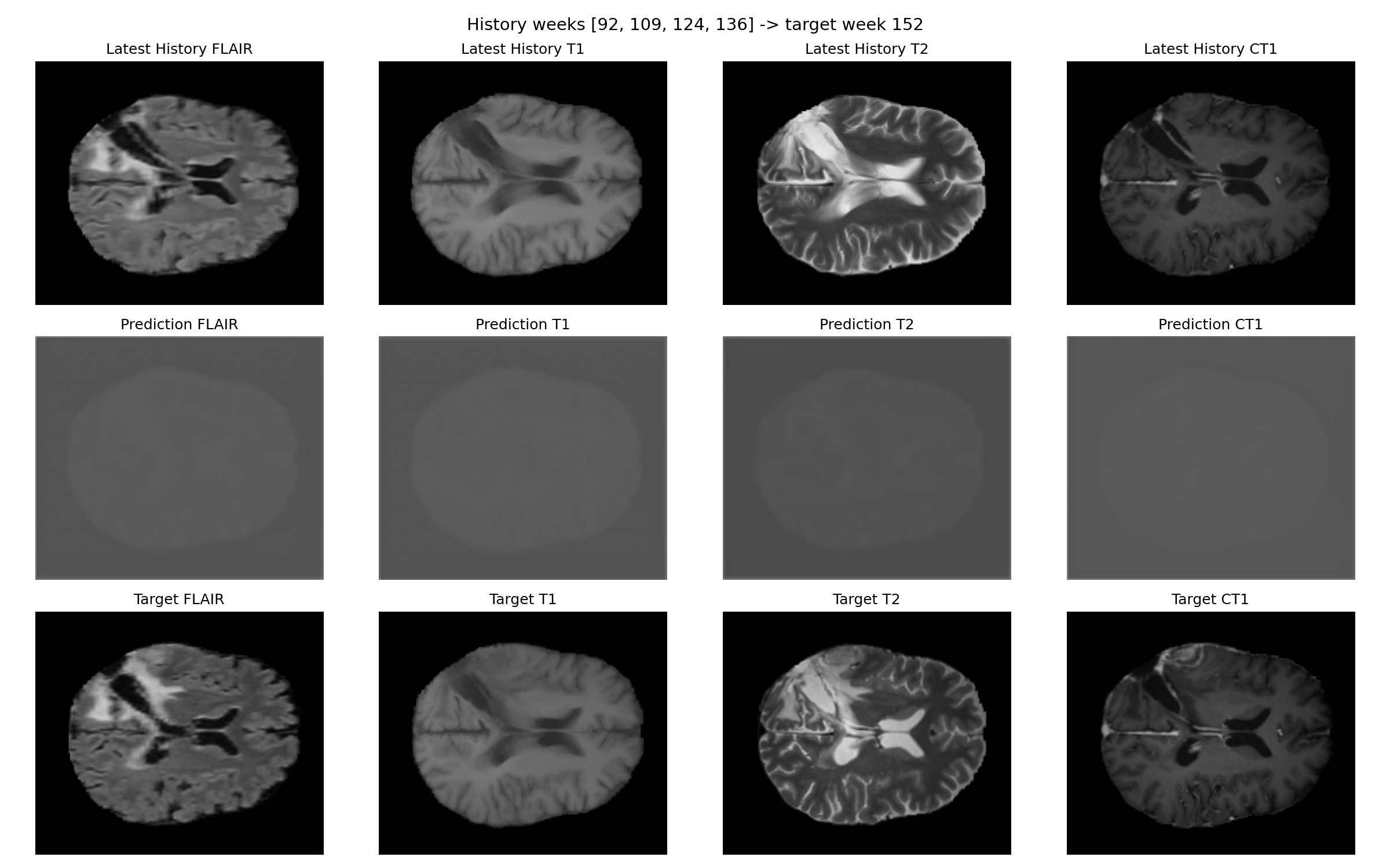 Prediction and target for patient 067