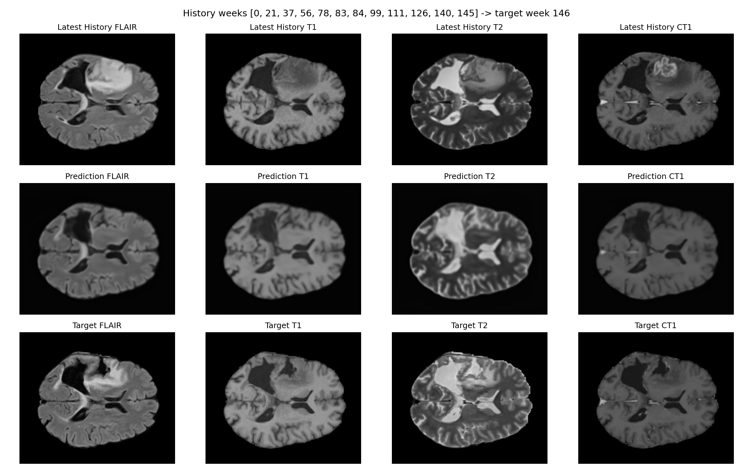 Forecast figure for Patient-015