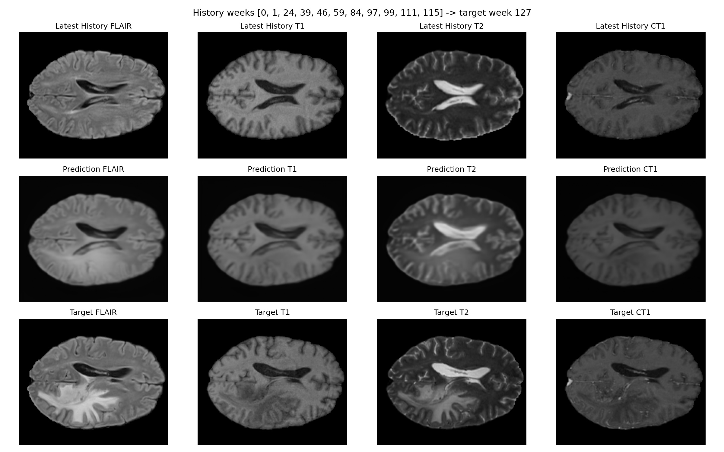 Forecast figure for Patient-023