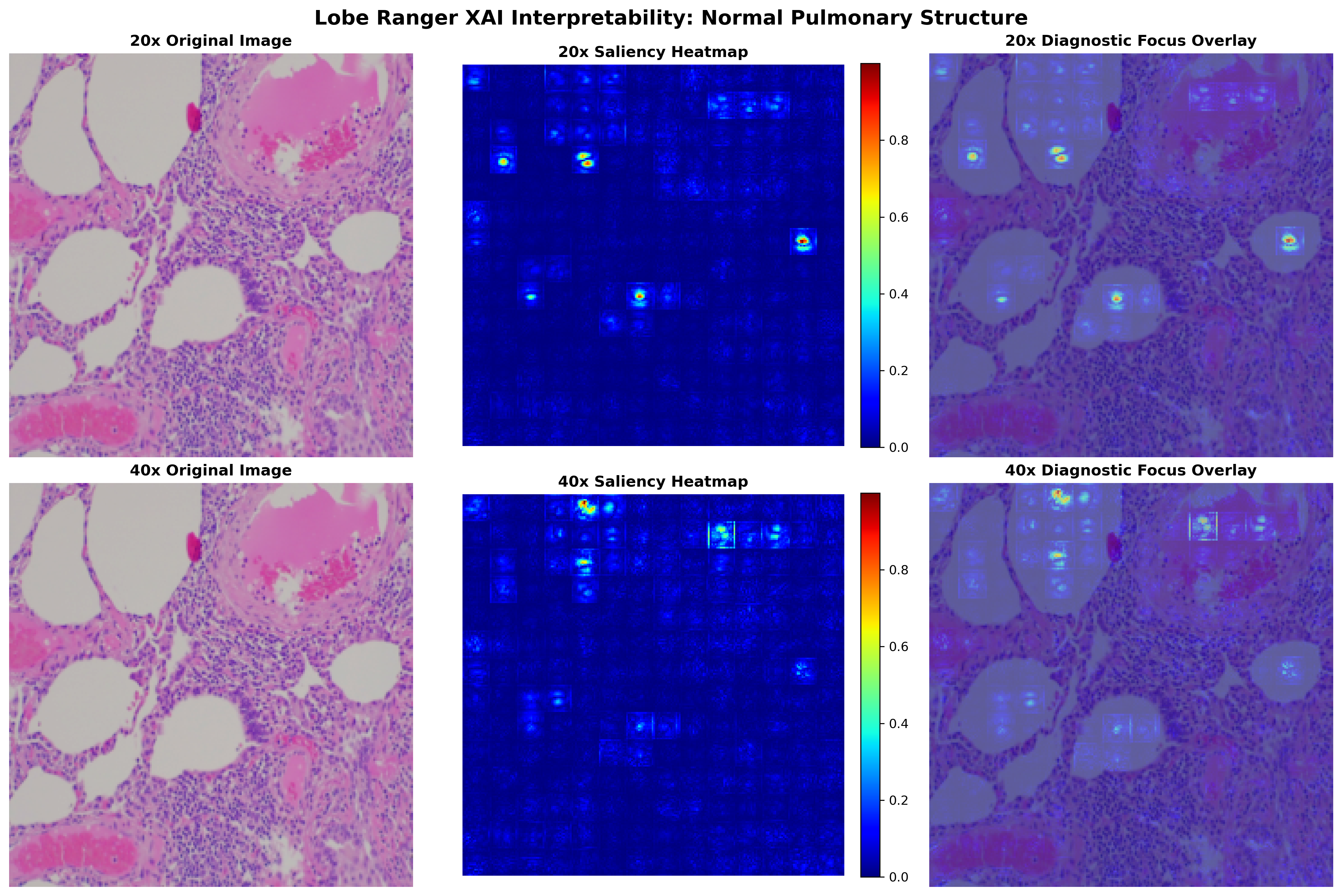 Normal Sample Saliency Map Focus