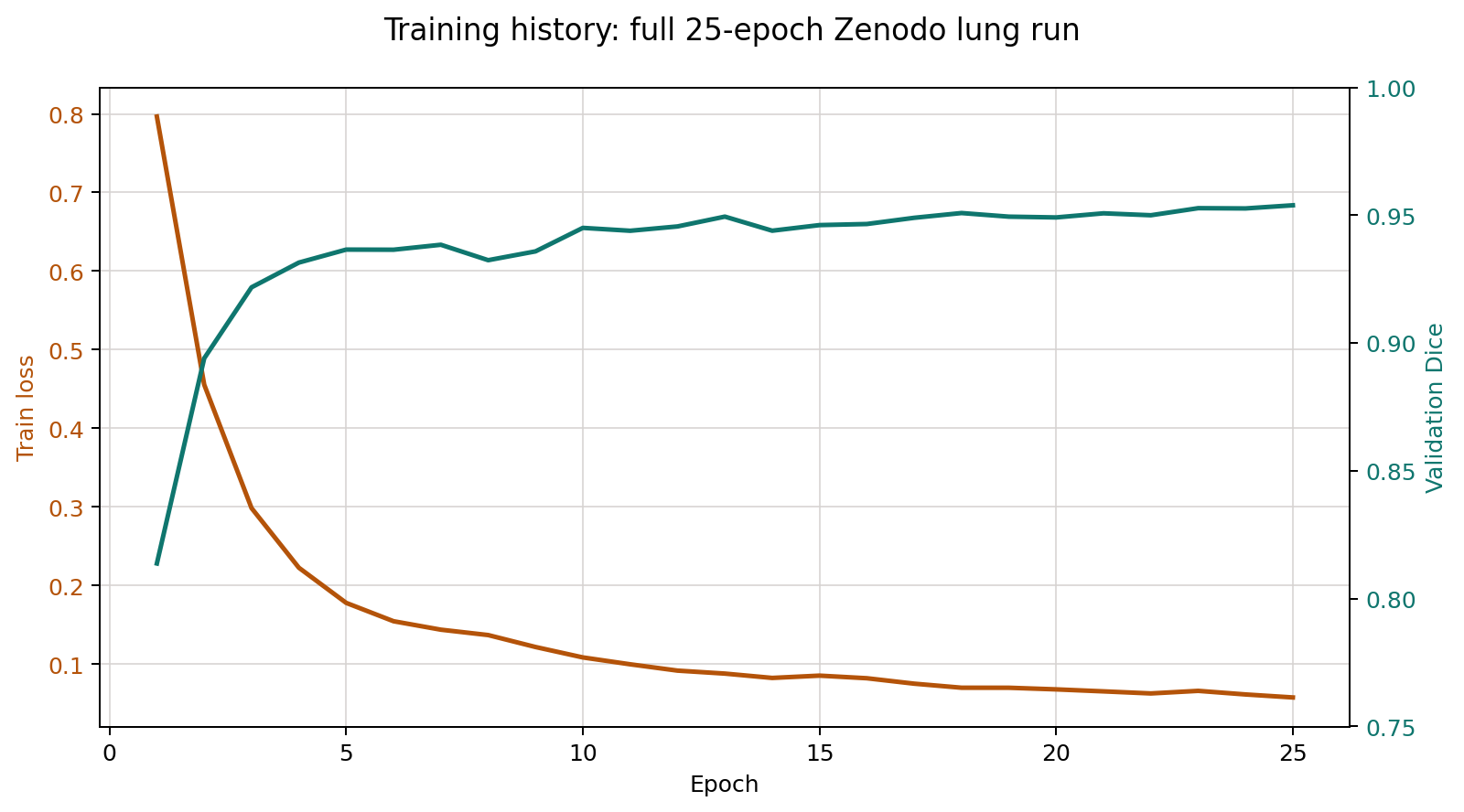 Training curve