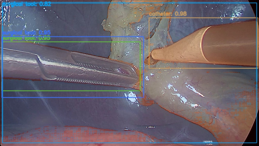 Prompt-grounded and segmented surgical tool overlay on a real Endoscapes frame